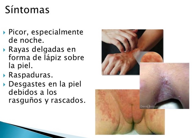 Las máscaras para 20 veraniego para la persona